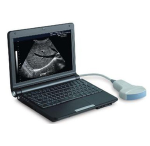 PT3000D1 Portable B/W Ultrasound Scanner