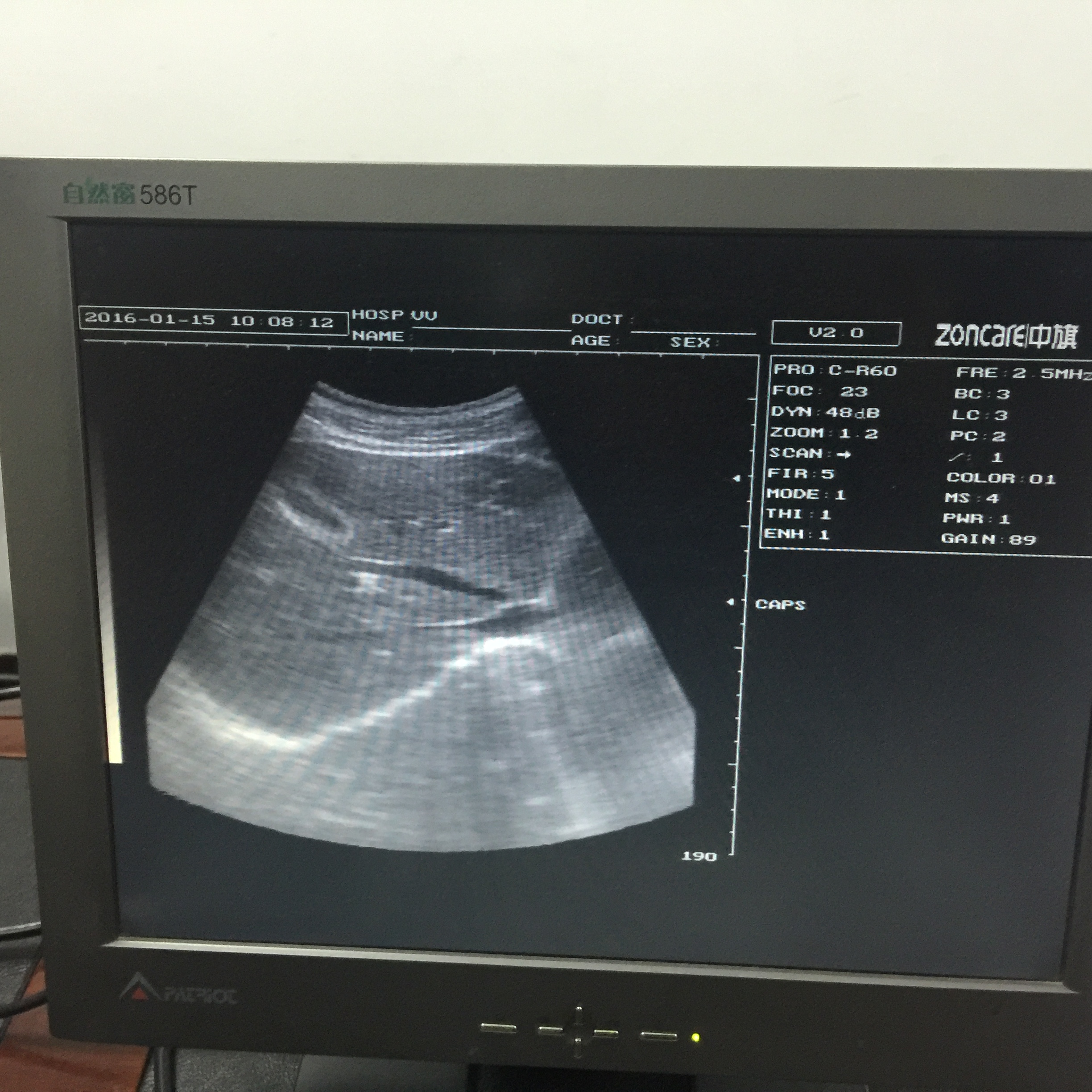 Training for Ultrasound Scanner